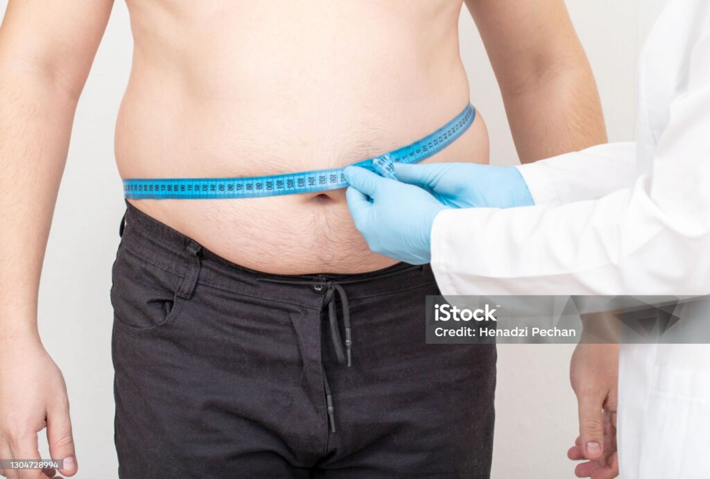 Cirurgia bariátrica: CFM muda as regras dos procedimentos